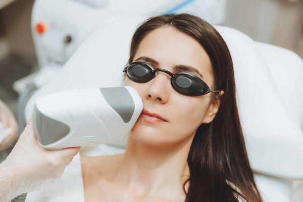 Les avantages de l'épilation du visage à la lumière pulsée : Une analyse détaillée